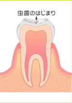 C0