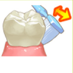 治療方法