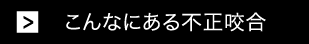 こんなにある不正咬合